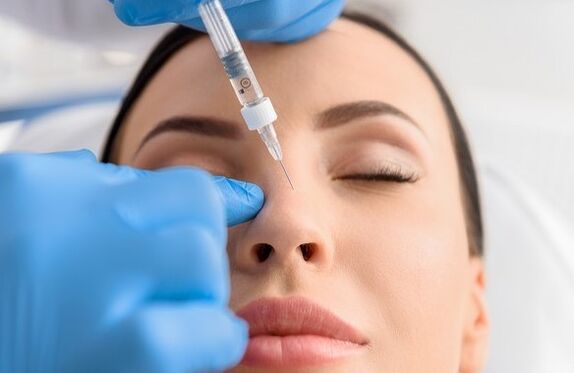 La méthode de rhinoplastie non churgicale