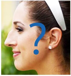 Déformation du nez après rhinoplastie.